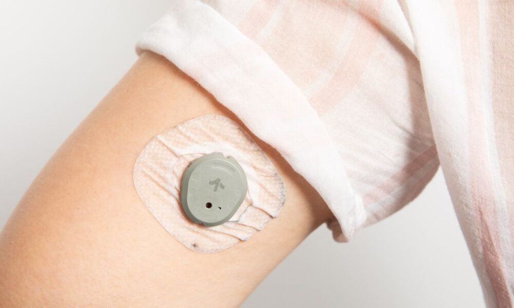 Dexcom Stelo hands-on: an OTC gadget in the war against diabetes