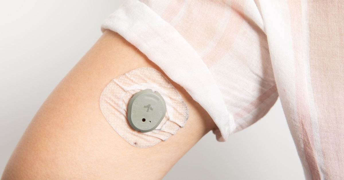 Dexcom Stelo hands-on: an OTC gadget in the war against diabetes